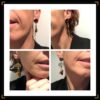 Les Zexotiques Zasymétriques – Image 3